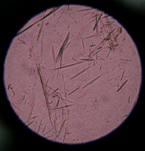 uric acid crystals urine on lawn